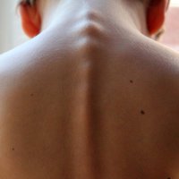 Faktoren für einen gesunden Rücken